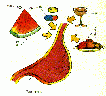 得了急性肠炎不治危害大吗