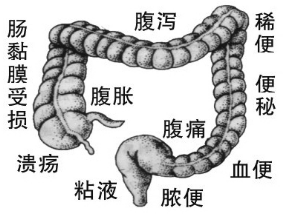 患急性肠炎的原因有哪些?